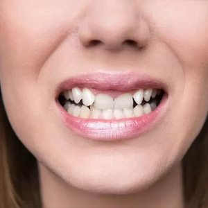Tình trạng răng miệng của khách hàng