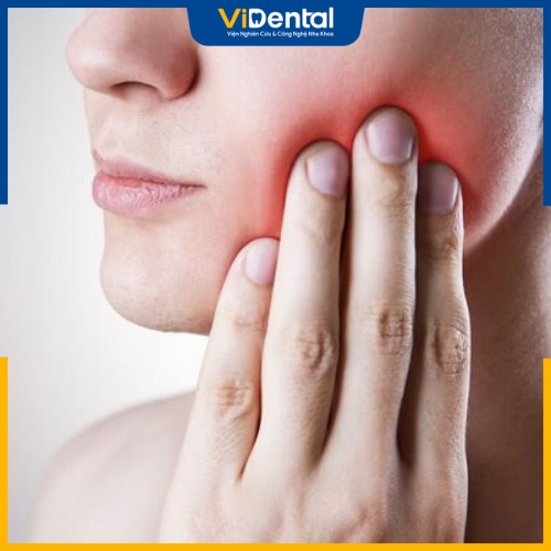 Răng khôn hàm dưới mọc ngầm gây đau nhức, sưng má