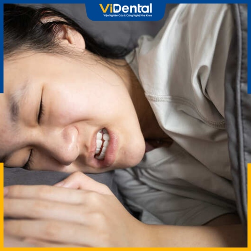 Tật nghiến răng gây áp lực lớn lên răng khiến răng dich chuyển lệch hướng 