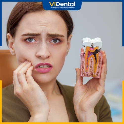 Sâu răng nặng ảnh hưởng xấu tới sức khỏe cơ thể