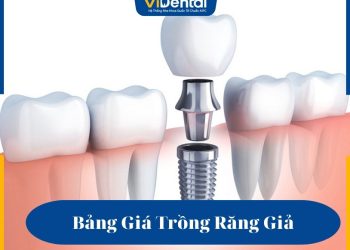 Bảng Giá Trồng Răng Giả