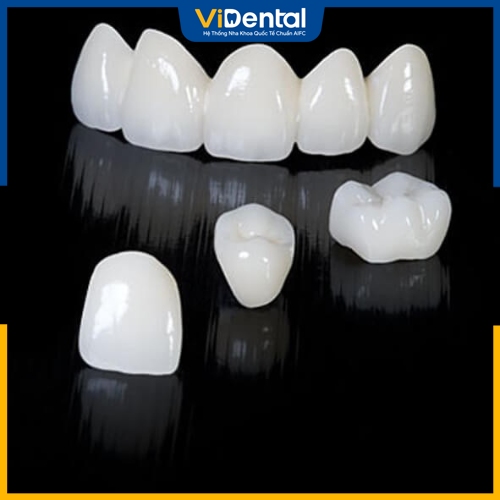 Răng toàn sứ - Các loại răng sứ nổi bật 