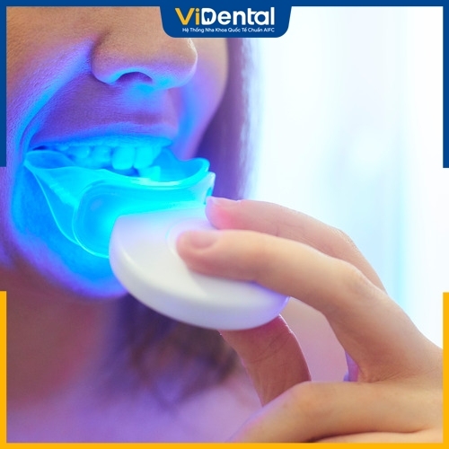 Máy tẩy trắng răng giúp loại bỏ nhanh chóng các vết ố vàng răng