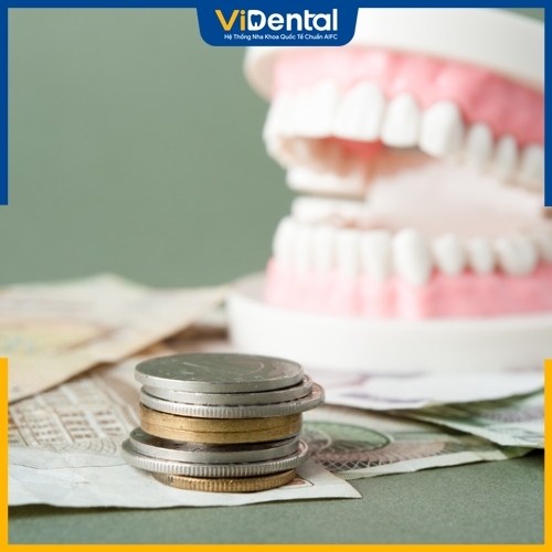 Nhổ răng tại Nha khoa ViDental giúp tiết kiệm chi phí