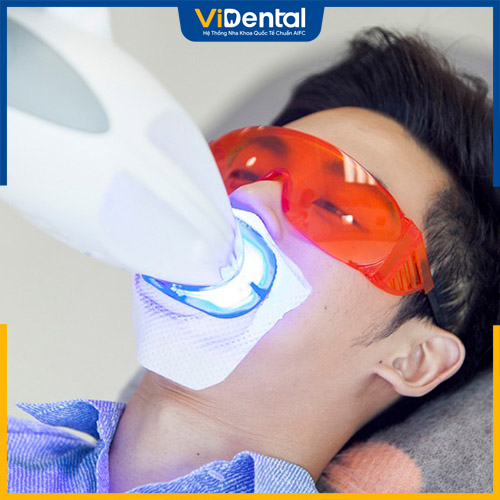 Tẩy trắng răng bằng laser đang dần trở nên phổ biến