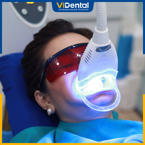 Chi phí tẩy trắng răng laser ở mỗi nha khoa sẽ khác nhau