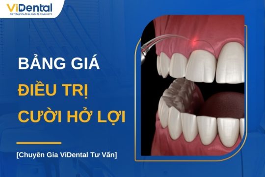 Bảng giá điều trị cười hở lợi