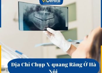 Địa chỉ chụp X-quang răng ở Hà Nội
