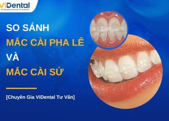 Mắc cài pha lê và mắc cài sứ khác biệt như thế nào