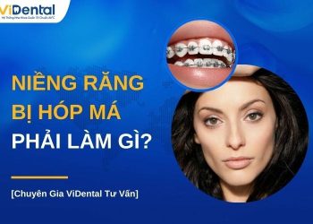 Niềng răng bị hóp má phải làm gì