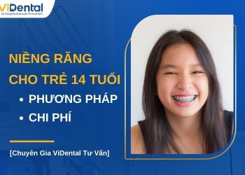 Niềng răng cho trẻ 14 tuổi bao nhiêu tiền