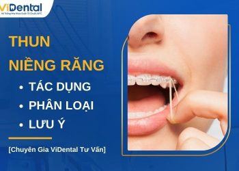 Thun niềng răng có tác dụng gì