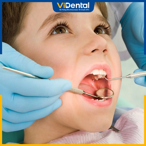 Trám răng điều trị giúp ngăn ngừa bệnh lý răng miệng