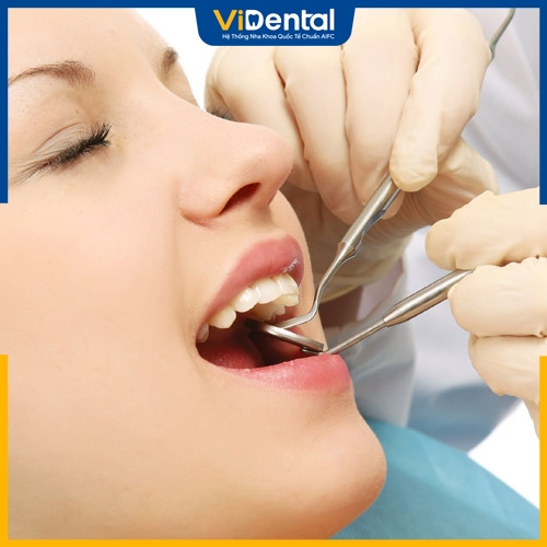 Trám răng có đau không phụ thuộc vào tay nghề và kỹ thuật của bác sĩ