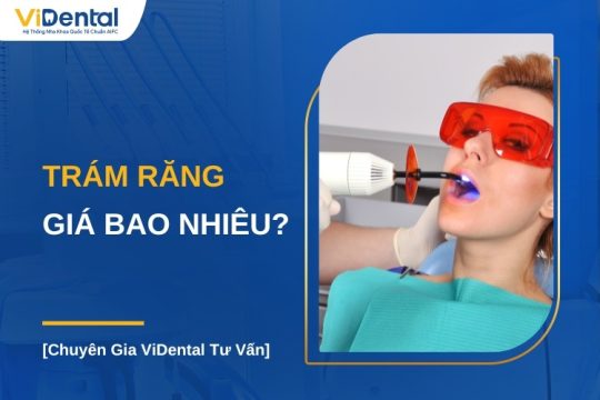 Trám răng giá bao nhiêu