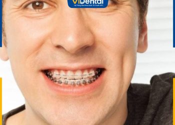40 tuổi có niềng răng được không