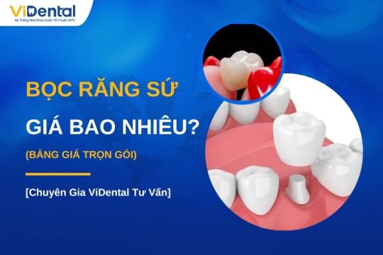 Cập nhật bảng giá bọc răng sứ mới nhất