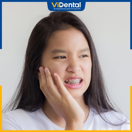 Niềng răng ảnh hưởng đến thần kinh gây đau nhức dữ dội