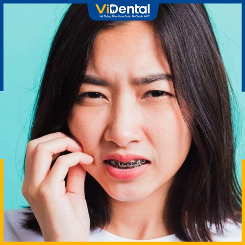 Niềng răng gây ta cảm giác đau nhức khó chịu thời gian đầu