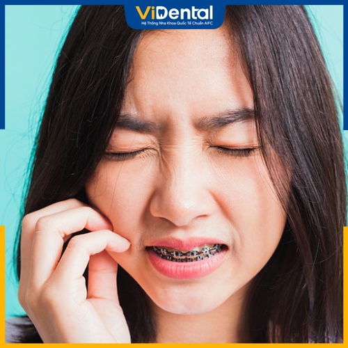 Tình trạng đau nhức kéo dài là triệu chứng thường gặp khi ca niềng răng gặp vấn đề 