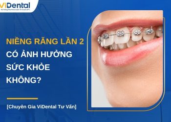 Niềng răng lần 2 có ảnh hưởng sức khỏe không