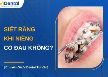 Siết răng khi niềng có đau không