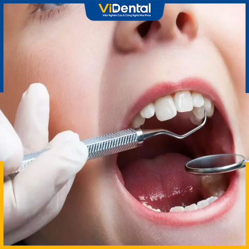 Trồng răng có niềng được không phụ thuộc vào kết quả khám