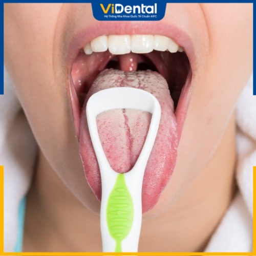 Vệ sinh lưỡi là một công đoạn quan trọng trong chu trình vệ sinh răng niềng