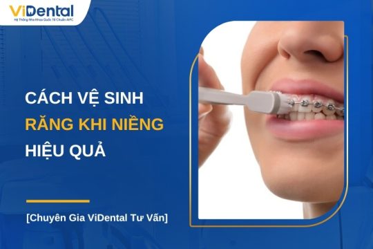 Cách vệ sin răng miệng khi niềng răng