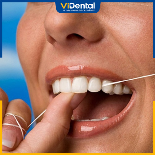 Dùng chỉ nha khoa để làm sạch răng tốt hơn
