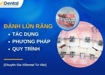 Đánh lún răng có tác dụng gì