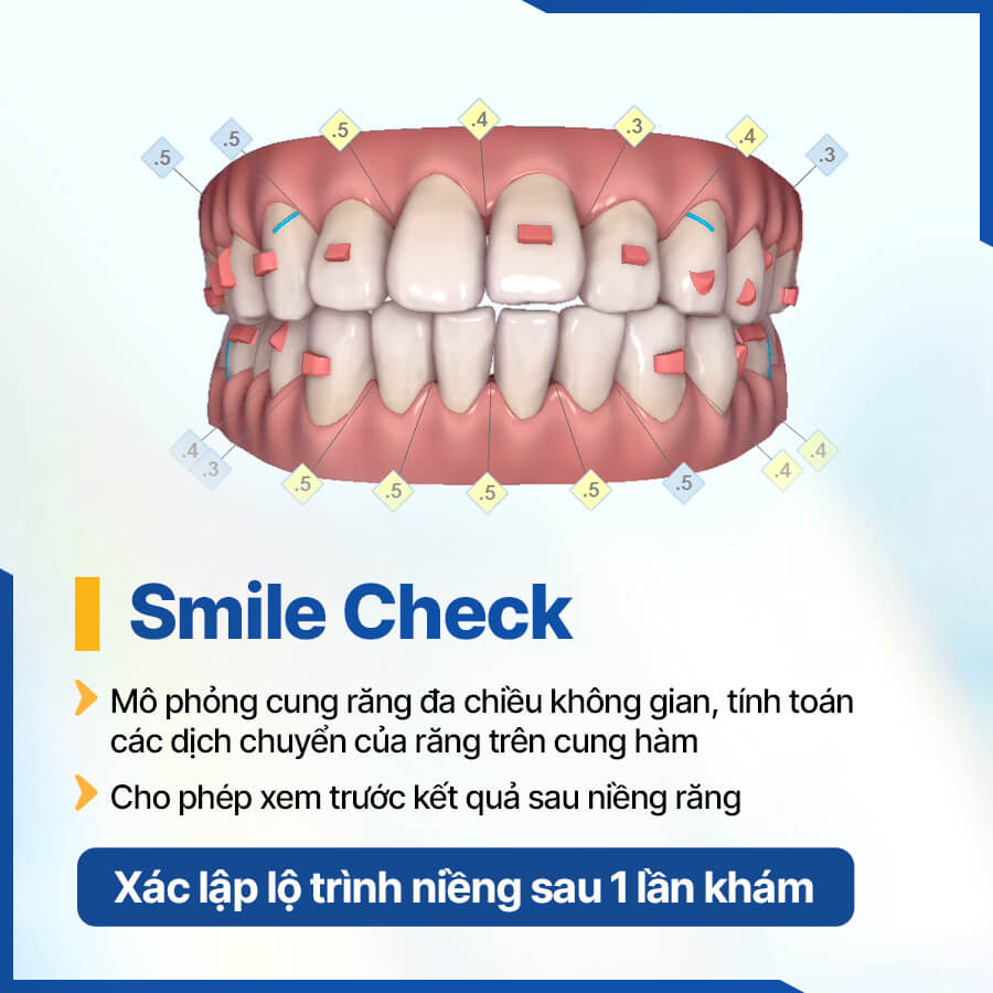 Công nghệ Smile Check tại nha khoa ViDental