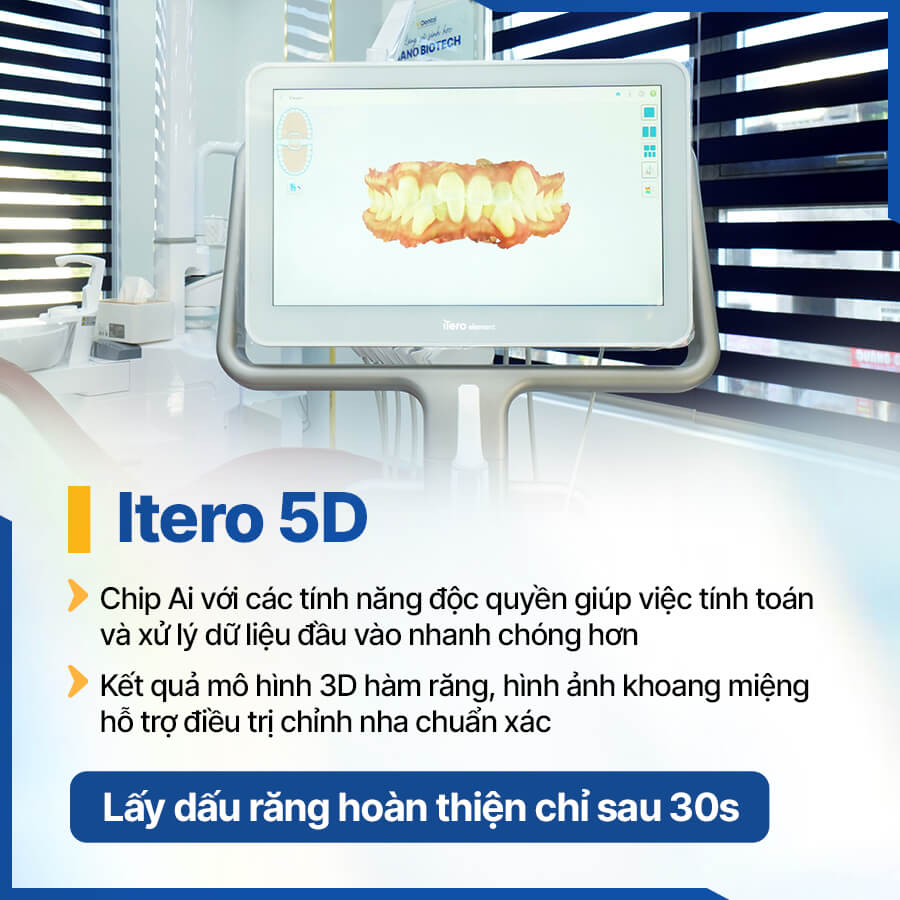 Máy quét dấu răng iTero 5D tại nha khoa ViDental