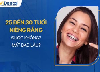 25 Đến 30 Tuổi Niềng Răng Được Không, Mất Thời Gian Bao Lâu?