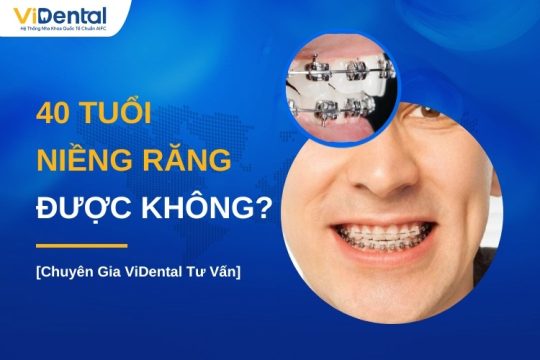 40 tuổi có niềng răng được không