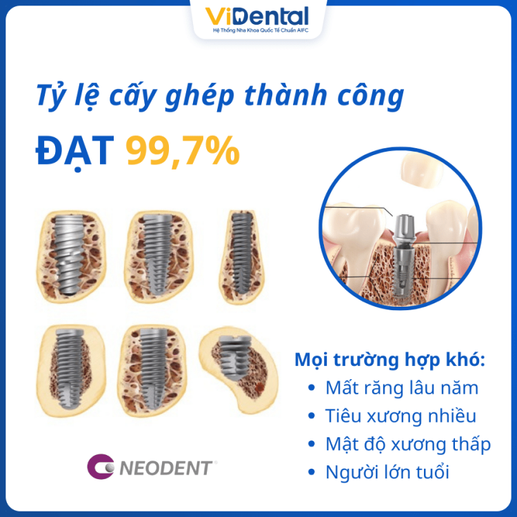 TRU-IMPLANT-NEODENT-4-750x750.png