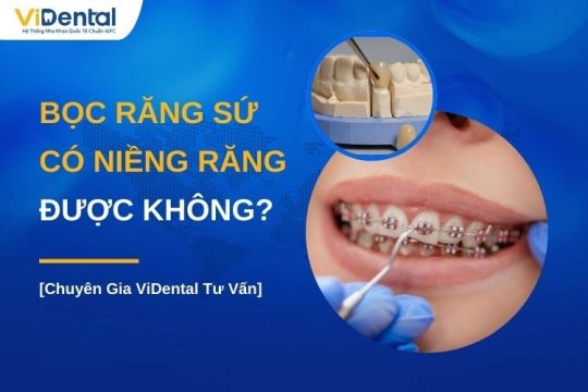 Bọc răng sứ có niềng răng được không