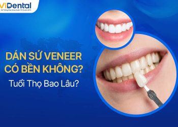 Dán Sứ Veneer Có Bền Không, Tuổi Thọ Bao Lâu?