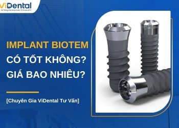 Implant Biotem có tốt không