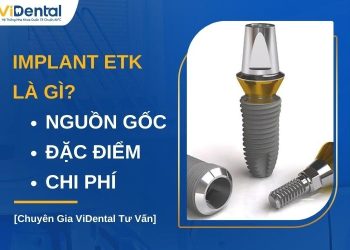 Implant ETK có tốt không