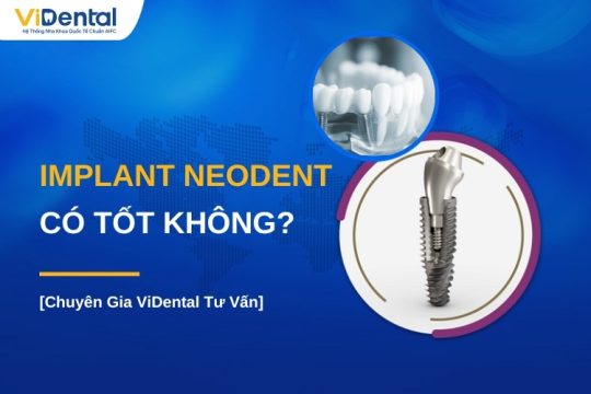 Implant Neodent có tốt không