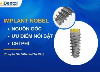 Implant Nobel có tốt không