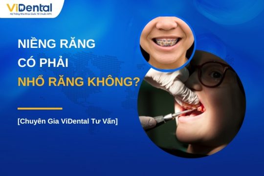 Niềng răng có phải nhổ răng không