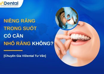 Niềng răng trong suốt có cần nhổ răng không