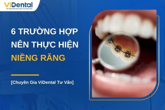 Răng như thế nào thì nên niềng