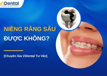 Răng sâu có niềng được không