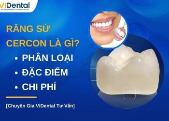 Răng sứ Cercon tốt không