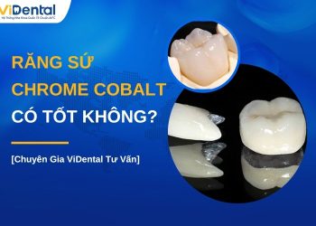 Răng sứ Chrome Cobalt có tốt không