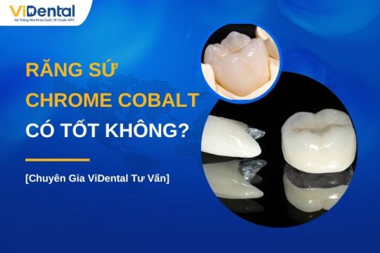 Răng sứ Chrome Cobalt có tốt không