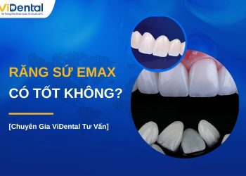 Răng sứ Emax có tốt không